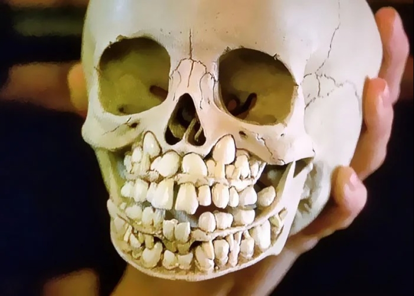 25 hechos extraños, espeluznantes y espeluznantes sobre el cuerpo humano 25 hechos extraños, espeluznantes y espeluznantes sobre el cuerpo humano
