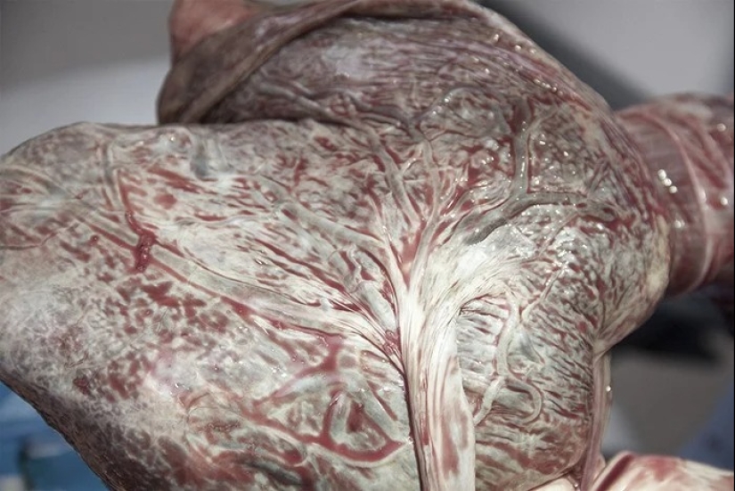 25 hechos extraños, espeluznantes y espeluznantes sobre el cuerpo humano 25 hechos extraños, espeluznantes y espeluznantes sobre el cuerpo humano