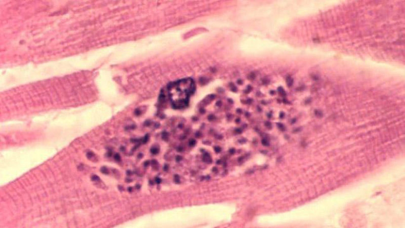 25 Most Unusual and Dangerous Parasites 25 Most Unusual and Dangerous Parasites