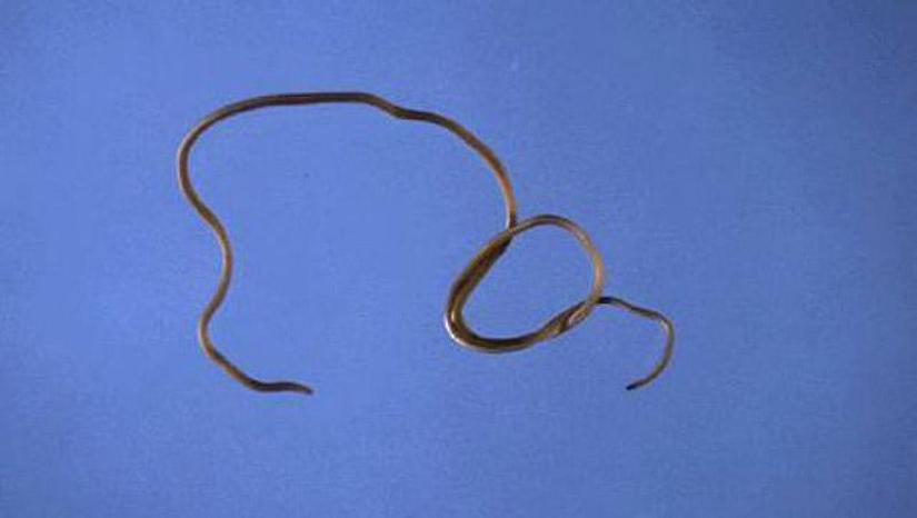25 Most Unusual and Dangerous Parasites 25 Most Unusual and Dangerous Parasites