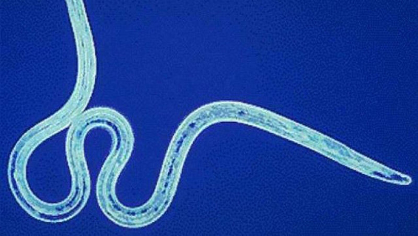 25 Most Unusual and Dangerous Parasites 25 Most Unusual and Dangerous Parasites