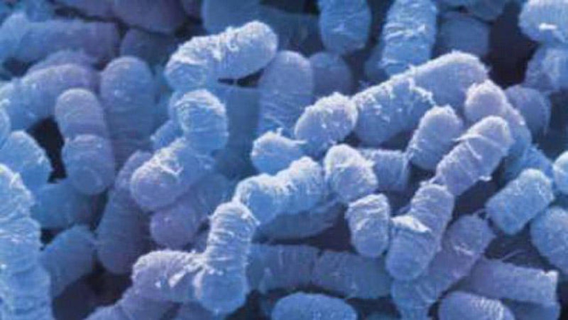 25 Most Unusual and Dangerous Parasites 25 Most Unusual and Dangerous Parasites