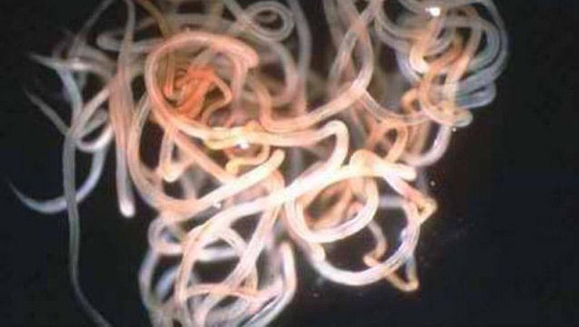 25 Most Unusual and Dangerous Parasites 25 Most Unusual and Dangerous Parasites