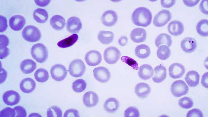 25 Most Unusual and Dangerous Parasites 25 Most Unusual and Dangerous Parasites