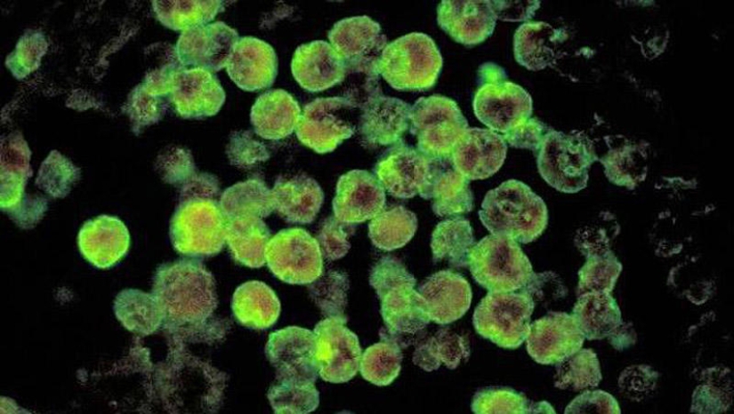 25 Most Unusual and Dangerous Parasites 25 Most Unusual and Dangerous Parasites