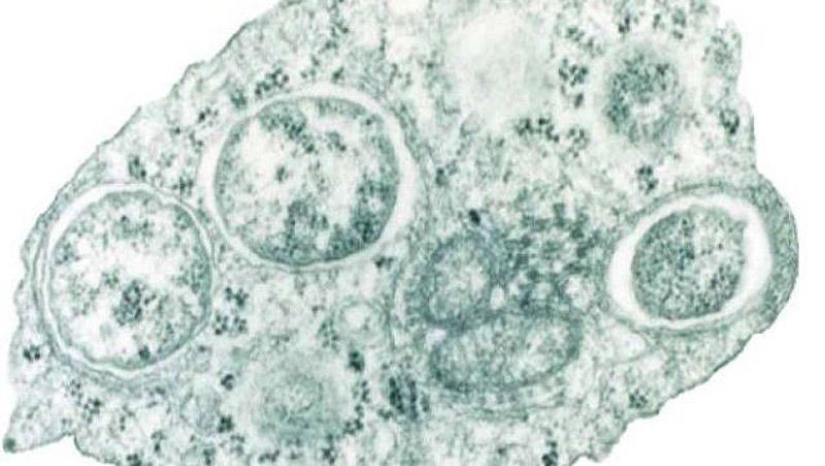 25 Most Unusual and Dangerous Parasites 25 Most Unusual and Dangerous Parasites