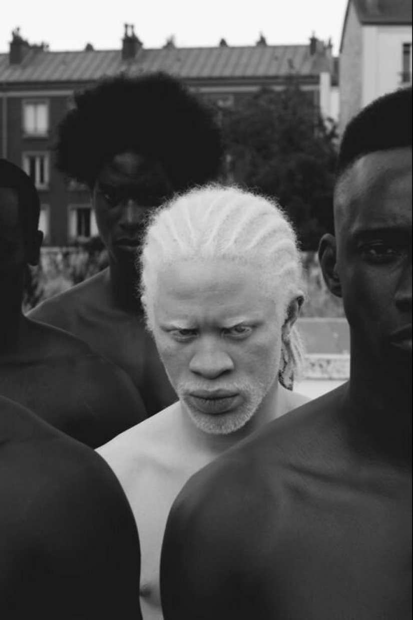 25 people with unique faces that attract and repel at the same time