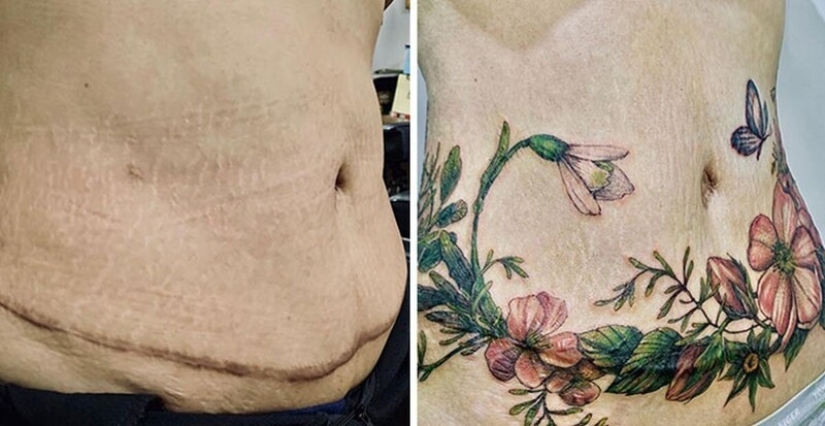 25 tatuajes para cubrir cicatrices y otros defectos en el cuerpo