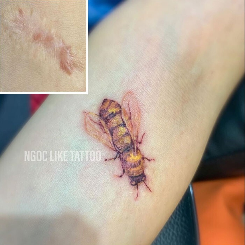 25 tatuajes para cubrir cicatrices y otros defectos en el cuerpo