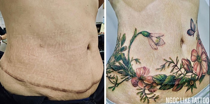25 tatuajes para cubrir cicatrices y otros defectos en el cuerpo