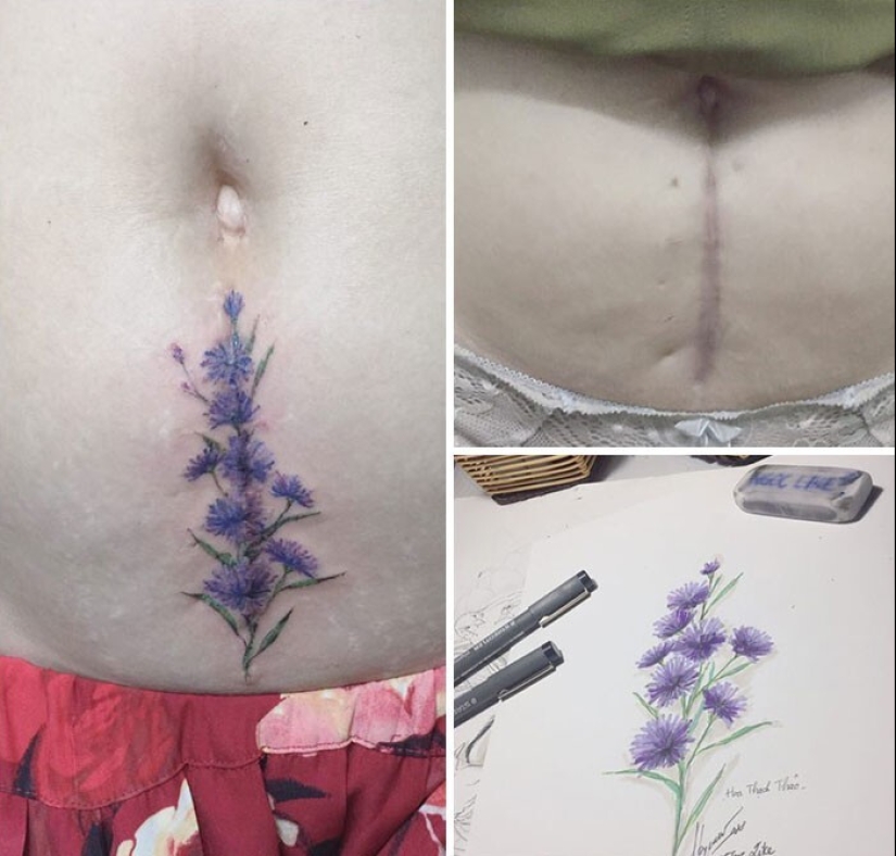 25 tatuajes para cubrir cicatrices y otros defectos en el cuerpo