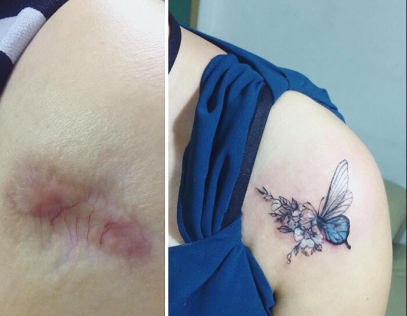 25 tatuajes para cubrir cicatrices y otros defectos en el cuerpo