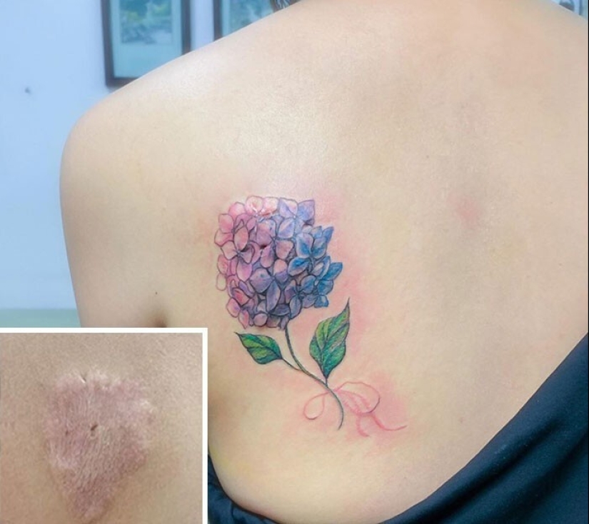 25 tatuajes para cubrir cicatrices y otros defectos en el cuerpo