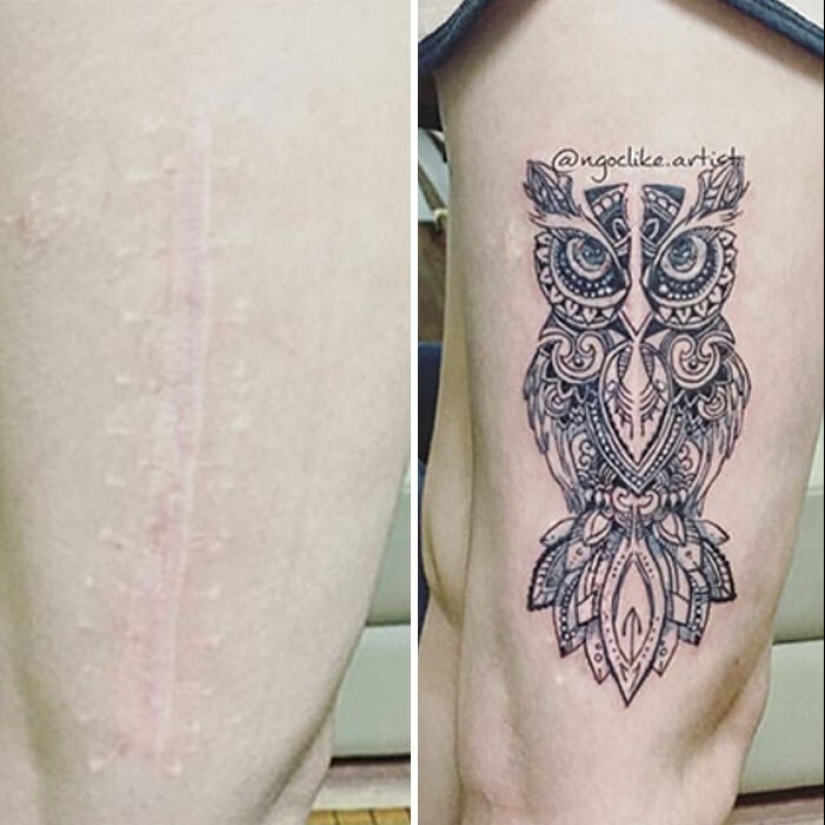 25 tatuajes para cubrir cicatrices y otros defectos en el cuerpo