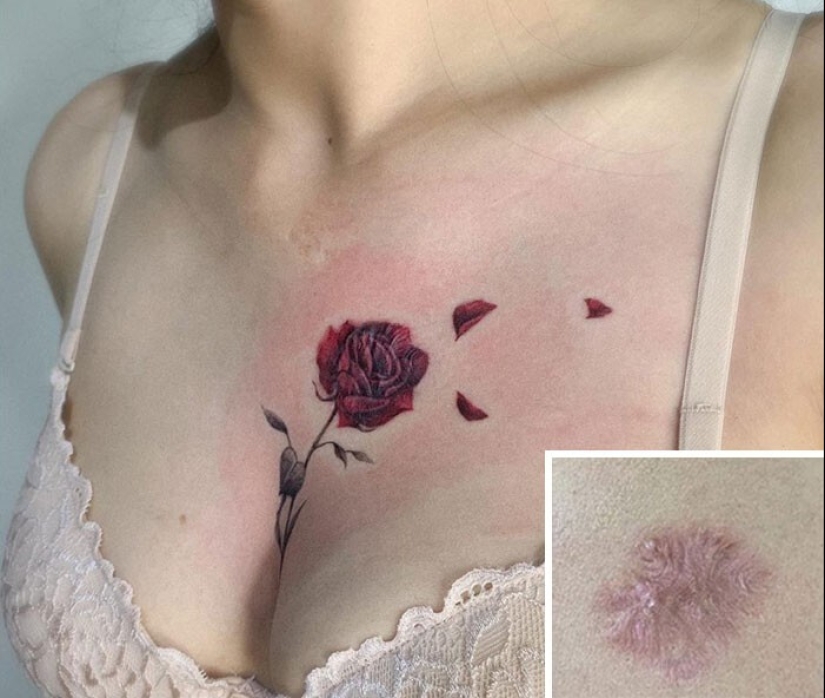 25 tatuajes para cubrir cicatrices y otros defectos en el cuerpo