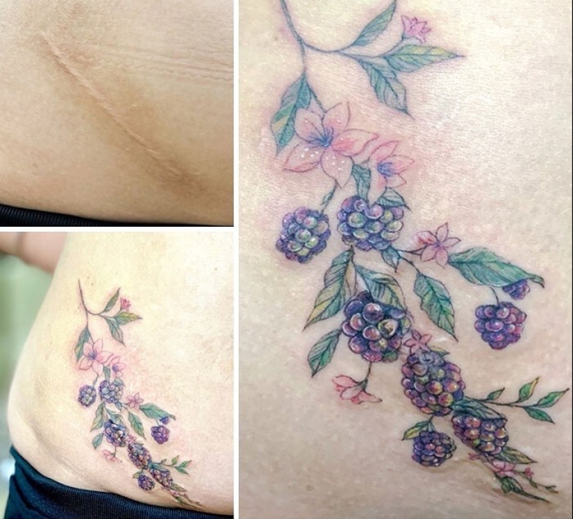 25 tatuajes para cubrir cicatrices y otros defectos en el cuerpo
