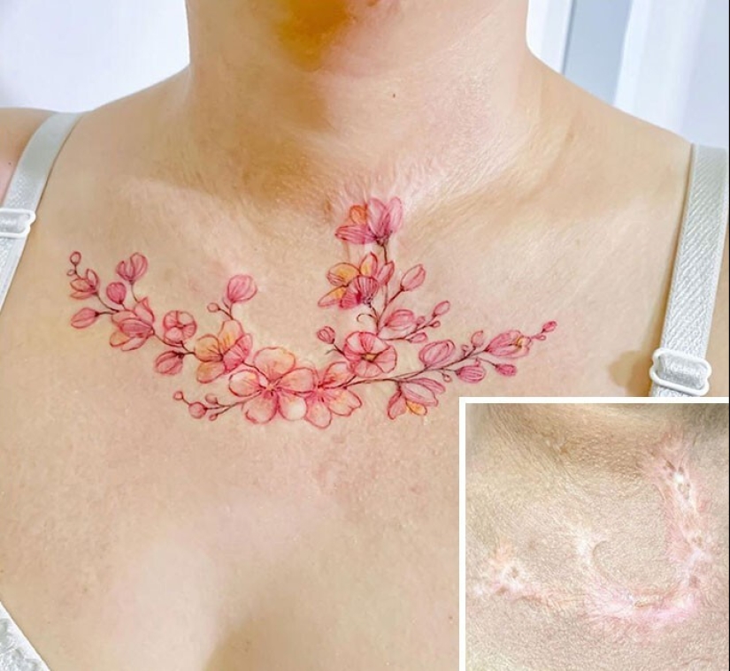 25 tatuajes para cubrir cicatrices y otros defectos en el cuerpo