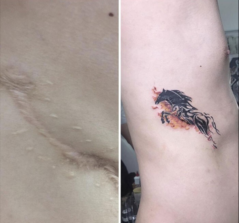 25 tatuajes para cubrir cicatrices y otros defectos en el cuerpo