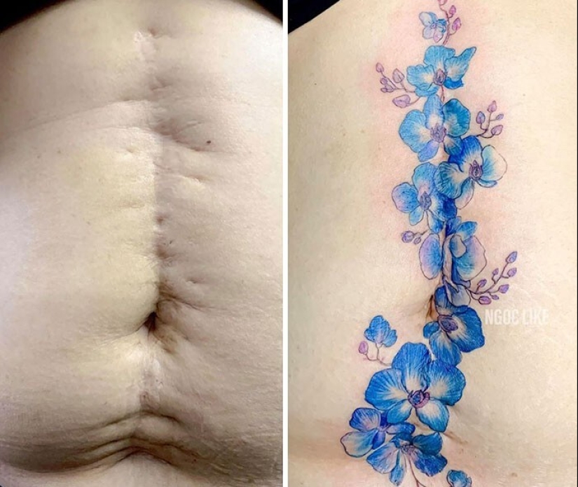 25 tatuajes para cubrir cicatrices y otros defectos en el cuerpo