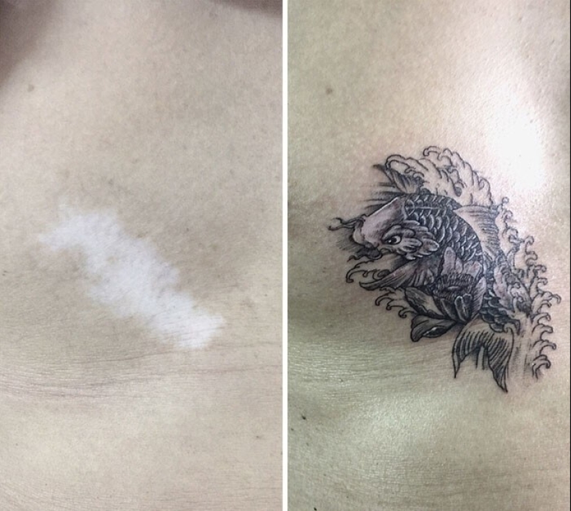 25 tatuajes para cubrir cicatrices y otros defectos en el cuerpo