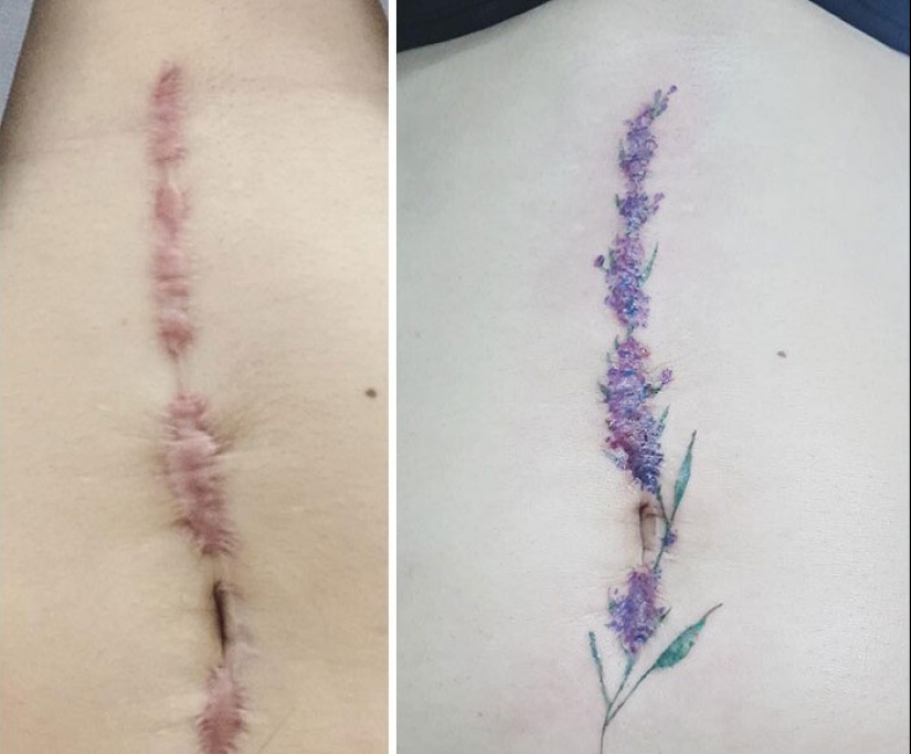 25 tatuajes para cubrir cicatrices y otros defectos en el cuerpo
