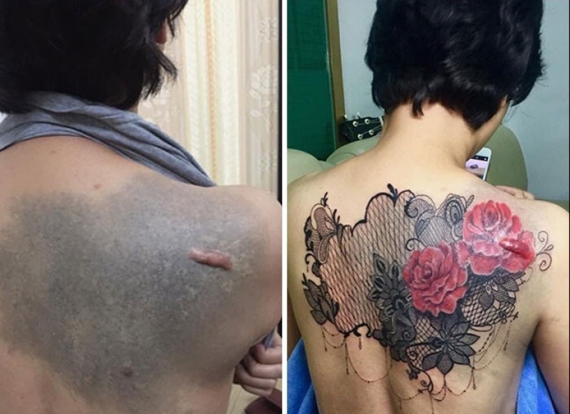 25 tatuajes para cubrir cicatrices y otros defectos en el cuerpo