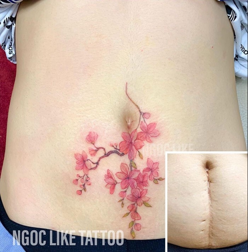 25 tatuajes para cubrir cicatrices y otros defectos en el cuerpo