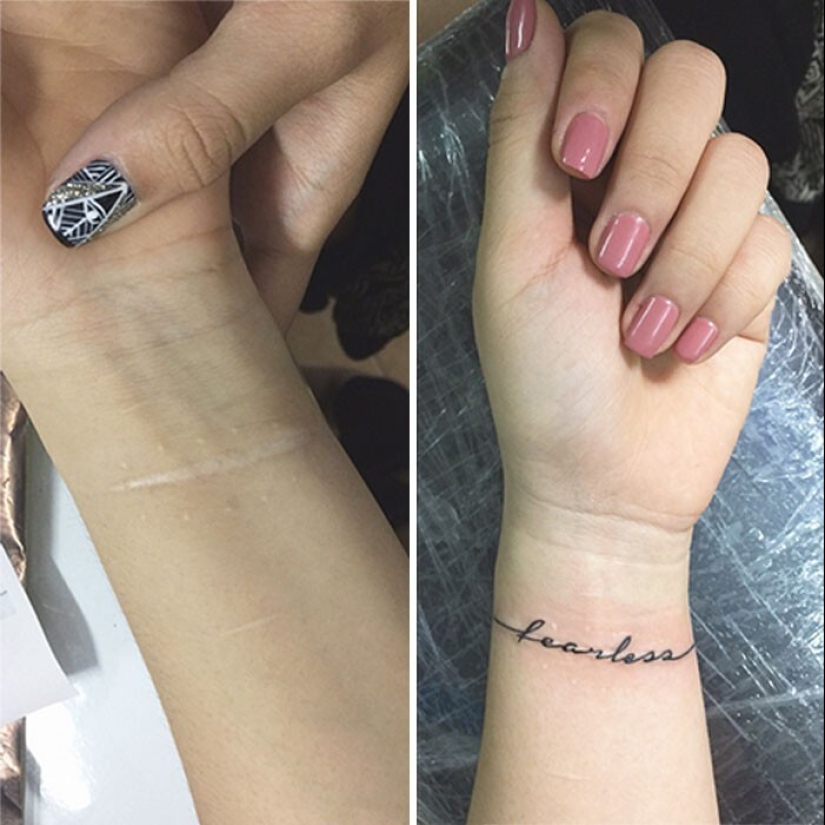 25 tatuajes para cubrir cicatrices y otros defectos en el cuerpo
