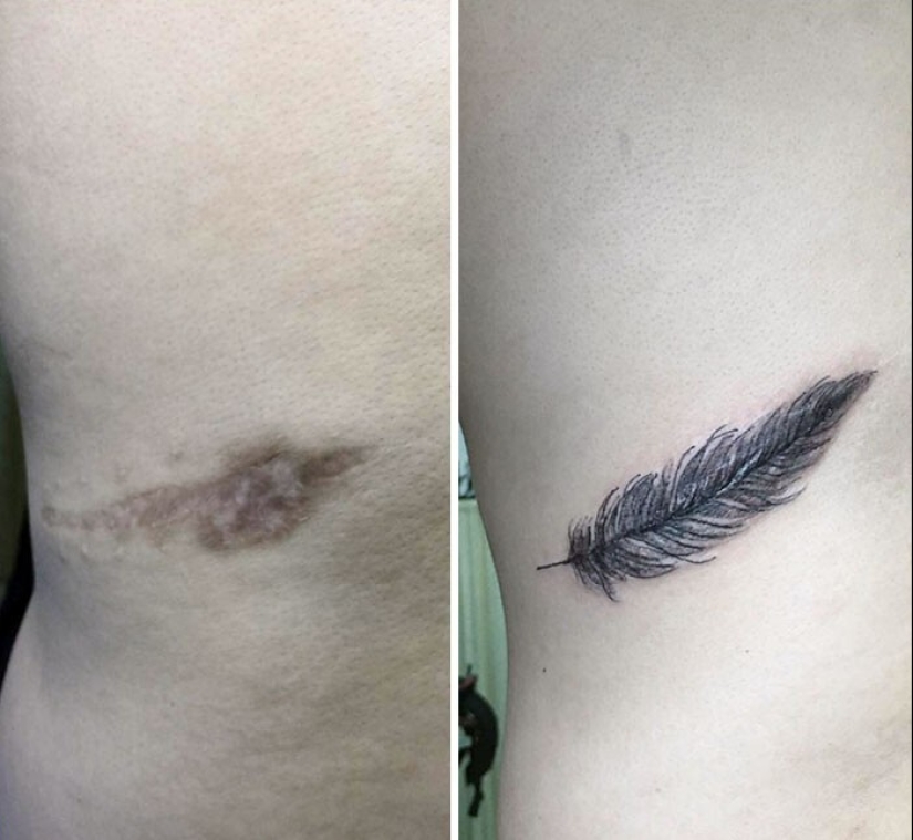 25 tatuajes para cubrir cicatrices y otros defectos en el cuerpo