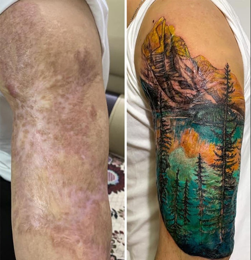 25 tatuajes para cubrir cicatrices y otros defectos en el cuerpo