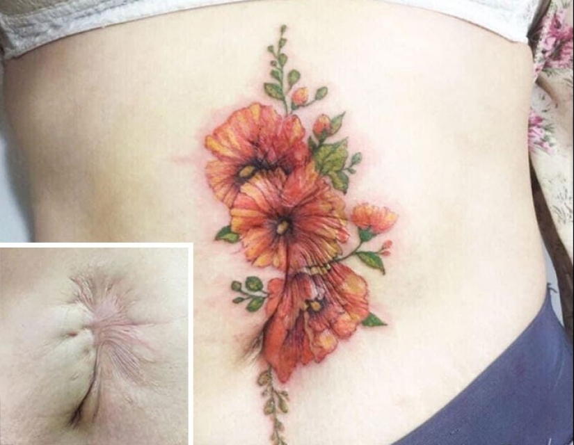 25 tatuajes para cubrir cicatrices y otros defectos en el cuerpo