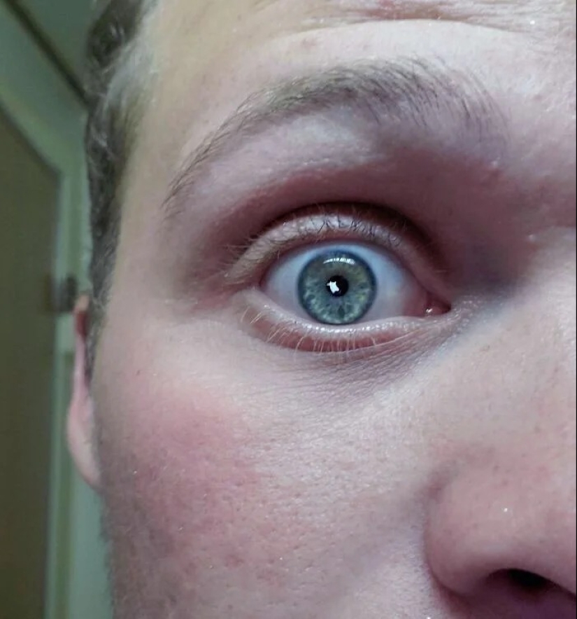 30 casos en los que las personas son increíblemente afortunadas