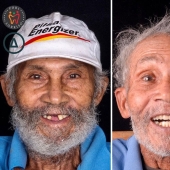 30 photos before and after people got their smile back 30 photos before and after people got their smile back