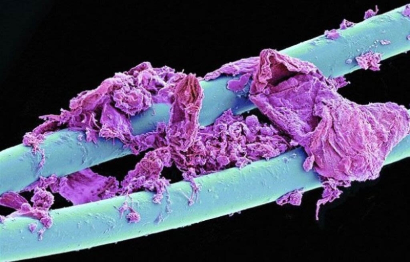 32 micrographs that will change your idea of the world