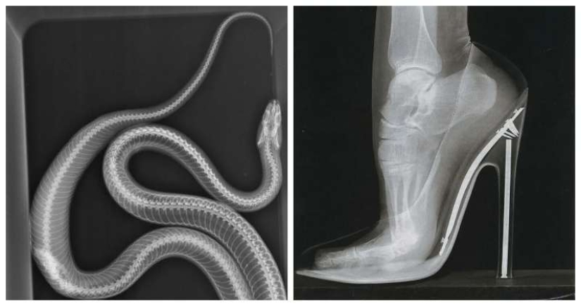 35 x-ray images that reveal the world from an unexpected quarter 35 x-ray images that reveal the world from an unexpected quarter