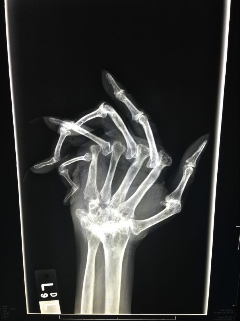 35 x-ray images that reveal the world from an unexpected quarter 35 x-ray images that reveal the world from an unexpected quarter