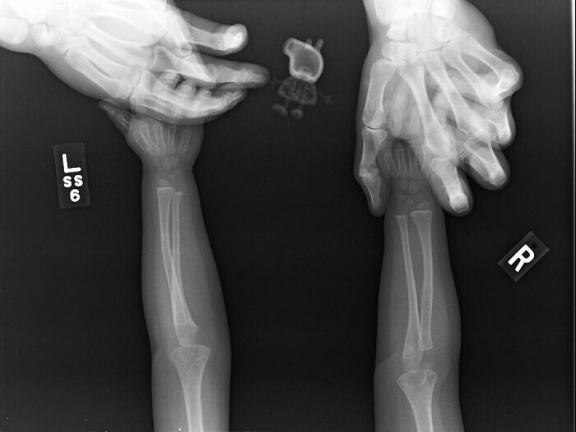 35 x-ray images that reveal the world from an unexpected quarter 35 x-ray images that reveal the world from an unexpected quarter