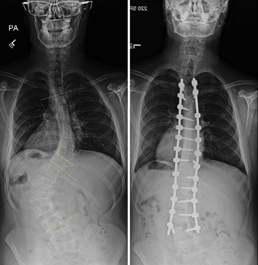 35 x-ray images that reveal the world from an unexpected quarter 35 x-ray images that reveal the world from an unexpected quarter