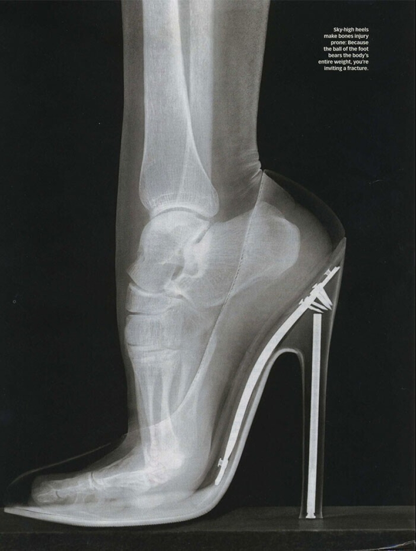 35 x-ray images that reveal the world from an unexpected quarter 35 x-ray images that reveal the world from an unexpected quarter