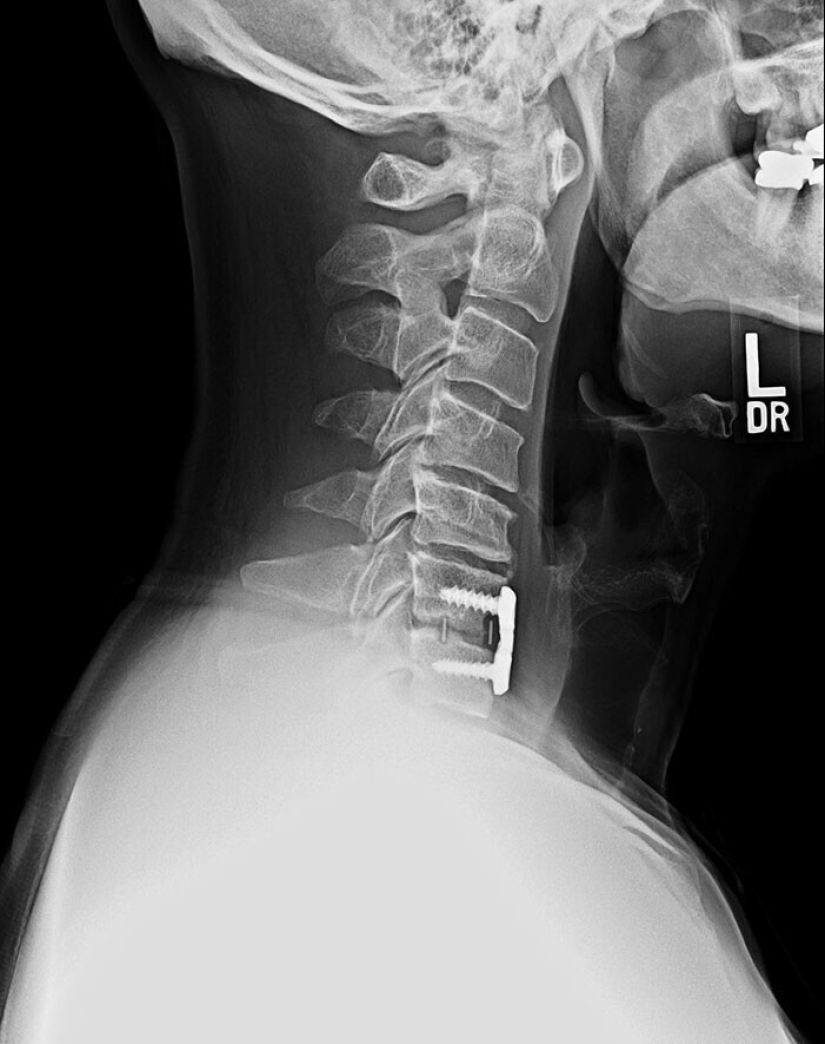 35 x-ray images that reveal the world from an unexpected quarter 35 x-ray images that reveal the world from an unexpected quarter