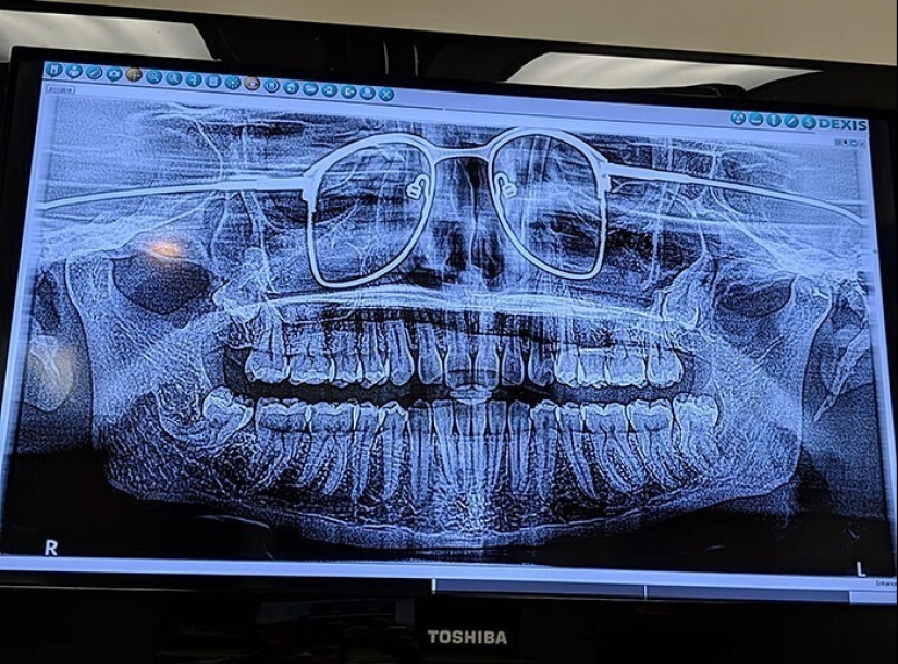 35 x-ray images that reveal the world from an unexpected quarter 35 x-ray images that reveal the world from an unexpected quarter