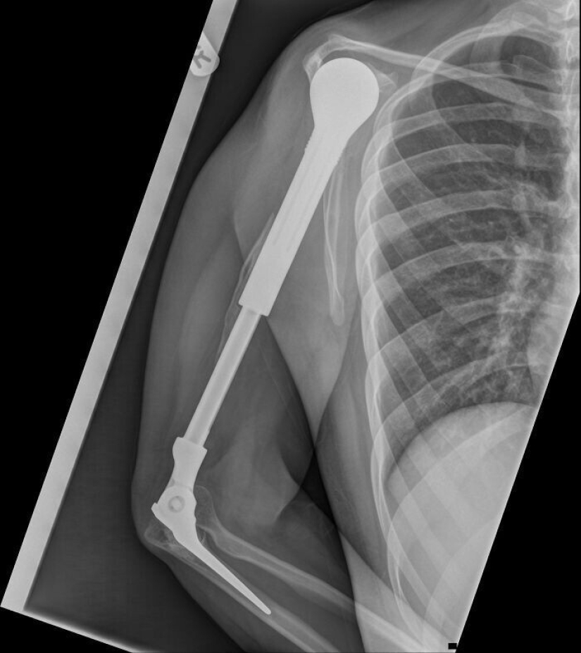 35 x-ray images that reveal the world from an unexpected quarter 35 x-ray images that reveal the world from an unexpected quarter
