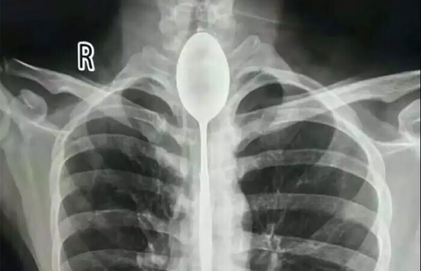 35 x-ray images that reveal the world from an unexpected quarter 35 x-ray images that reveal the world from an unexpected quarter