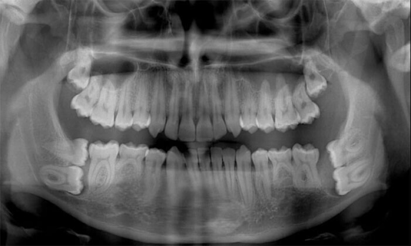 35 x-ray images that reveal the world from an unexpected quarter 35 x-ray images that reveal the world from an unexpected quarter