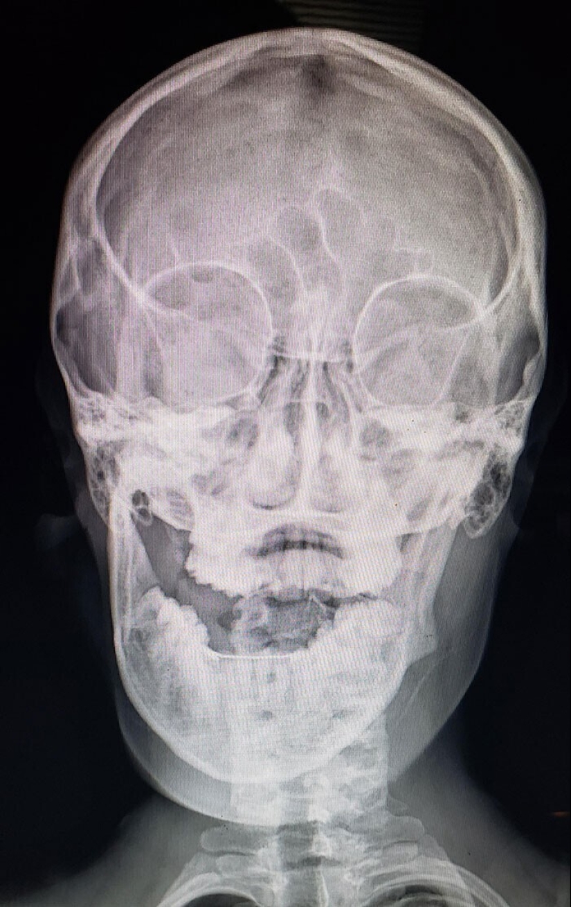 35 x-ray images that reveal the world from an unexpected quarter 35 x-ray images that reveal the world from an unexpected quarter