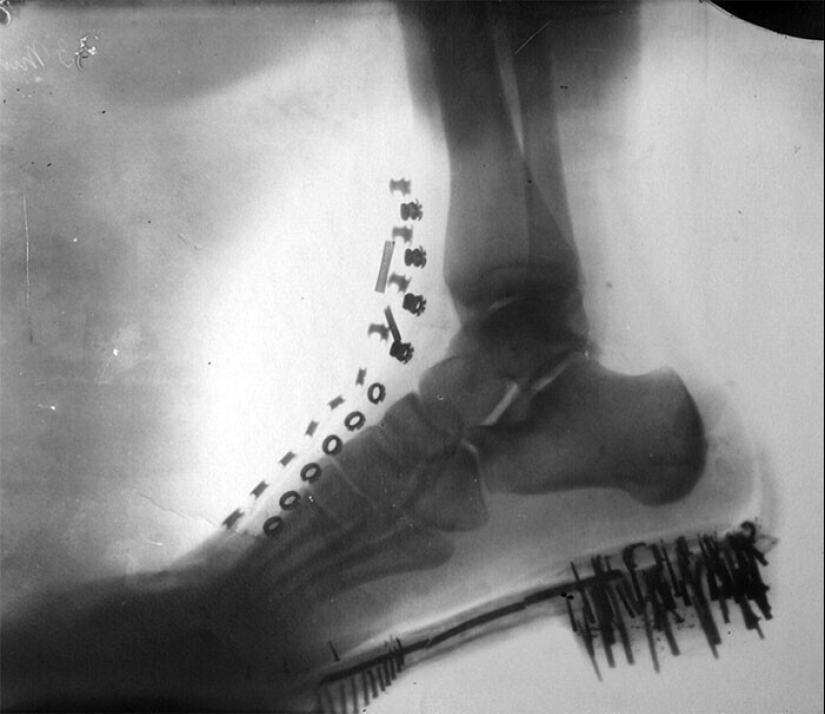 35 x-ray images that reveal the world from an unexpected quarter 35 x-ray images that reveal the world from an unexpected quarter