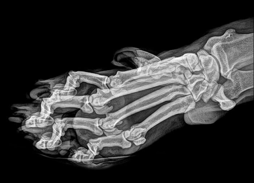 35 x-ray images that reveal the world from an unexpected quarter 35 x-ray images that reveal the world from an unexpected quarter