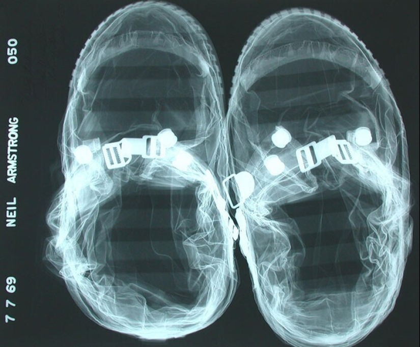 35 x-ray images that reveal the world from an unexpected quarter 35 x-ray images that reveal the world from an unexpected quarter