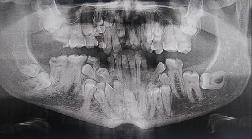 35 x-ray images that reveal the world from an unexpected quarter 35 x-ray images that reveal the world from an unexpected quarter