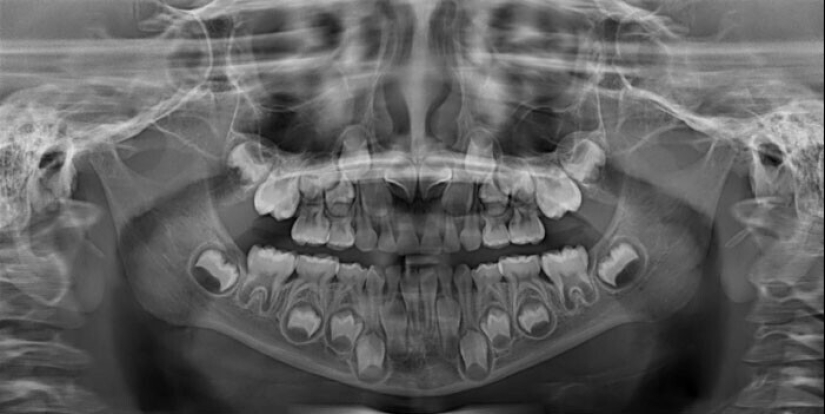 35 x-ray images that reveal the world from an unexpected quarter 35 x-ray images that reveal the world from an unexpected quarter